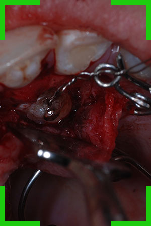 Chirurgia Odontoiatrica